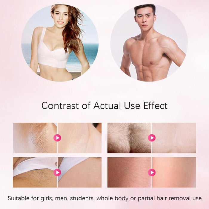 Professional IPL Epilator Laser Hair Removal - shop.livefree.co.uk